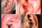 DID YOU KNOW⚠️⚠️that if hair grows on your ears, it’s because your body is…. Read more
